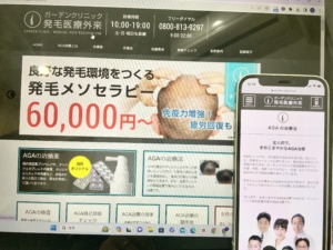 聖心毛髪再生外来名古屋